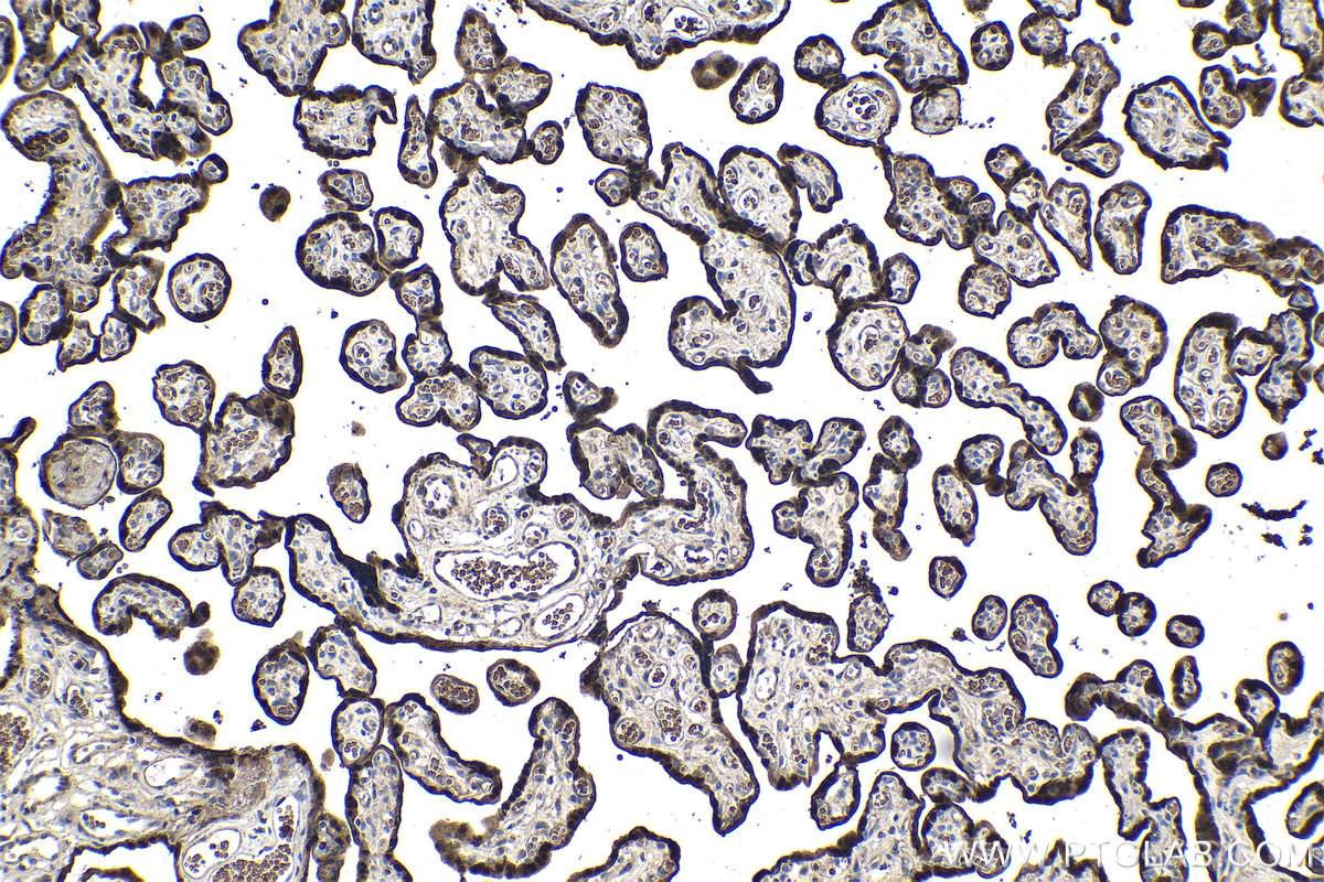 Immunohistochemistry (IHC) staining of human placenta tissue using HOPX Polyclonal antibody (11419-1-AP)