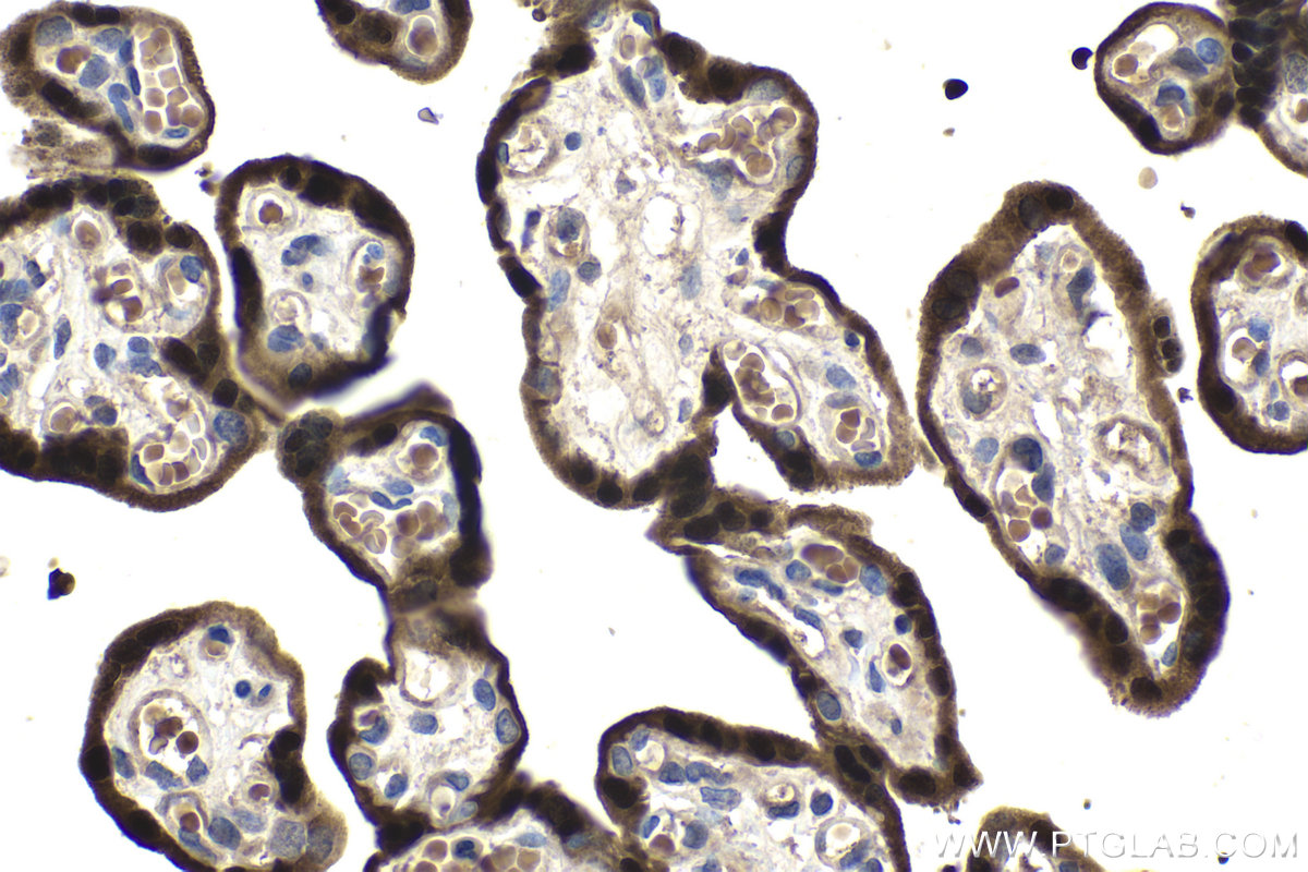 Immunohistochemistry (IHC) staining of human placenta tissue using HOPX Polyclonal antibody (11419-1-AP)