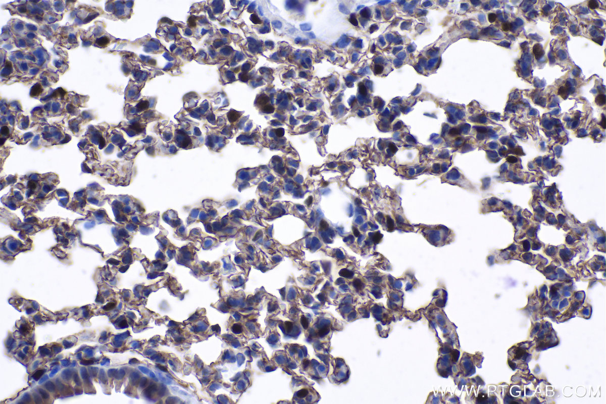 Immunohistochemistry (IHC) staining of mouse lung tissue using HOPX Polyclonal antibody (11419-1-AP)
