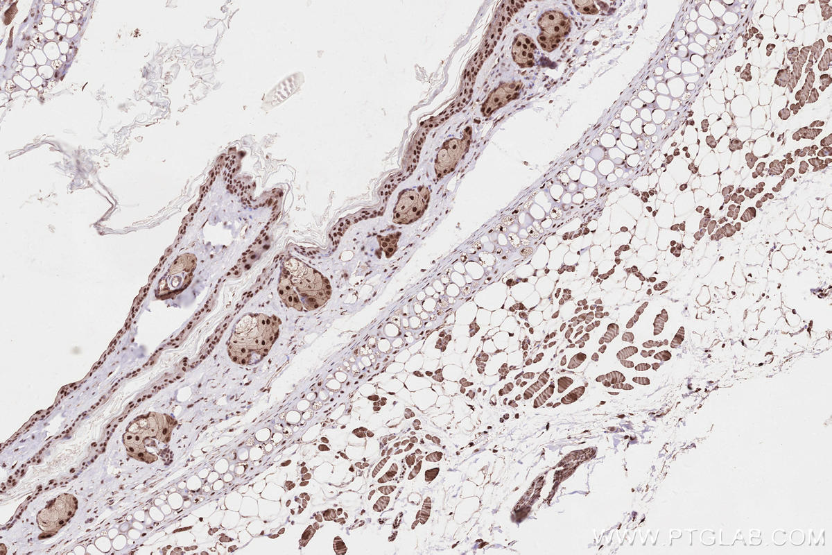 Immunohistochemistry (IHC) staining of mouse skin tissue using HORMAD1 Polyclonal antibody (28719-1-AP)