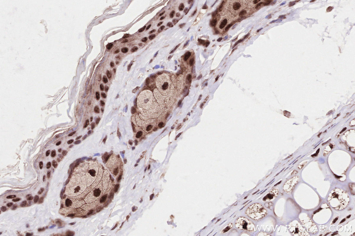 Immunohistochemistry (IHC) staining of mouse skin tissue using HORMAD1 Polyclonal antibody (28719-1-AP)