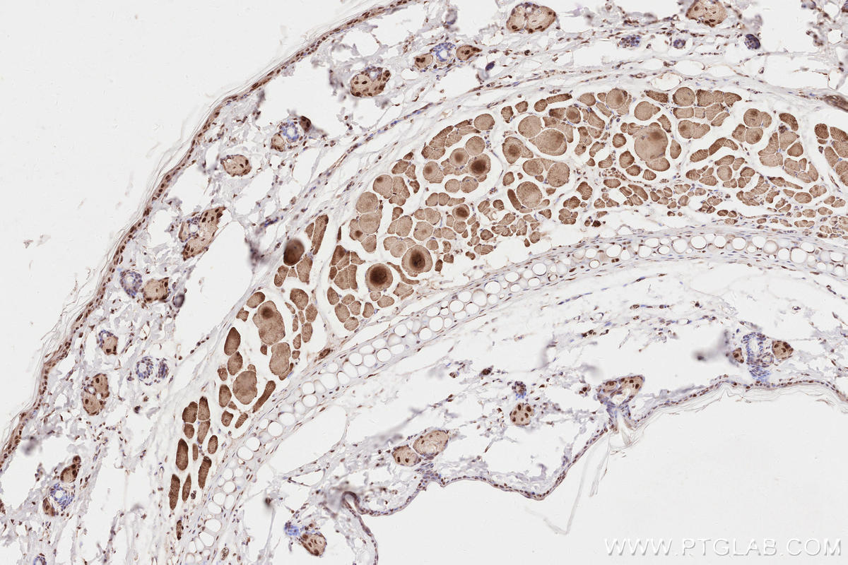 Immunohistochemistry (IHC) staining of rat skin tissue using HORMAD1 Polyclonal antibody (28719-1-AP)