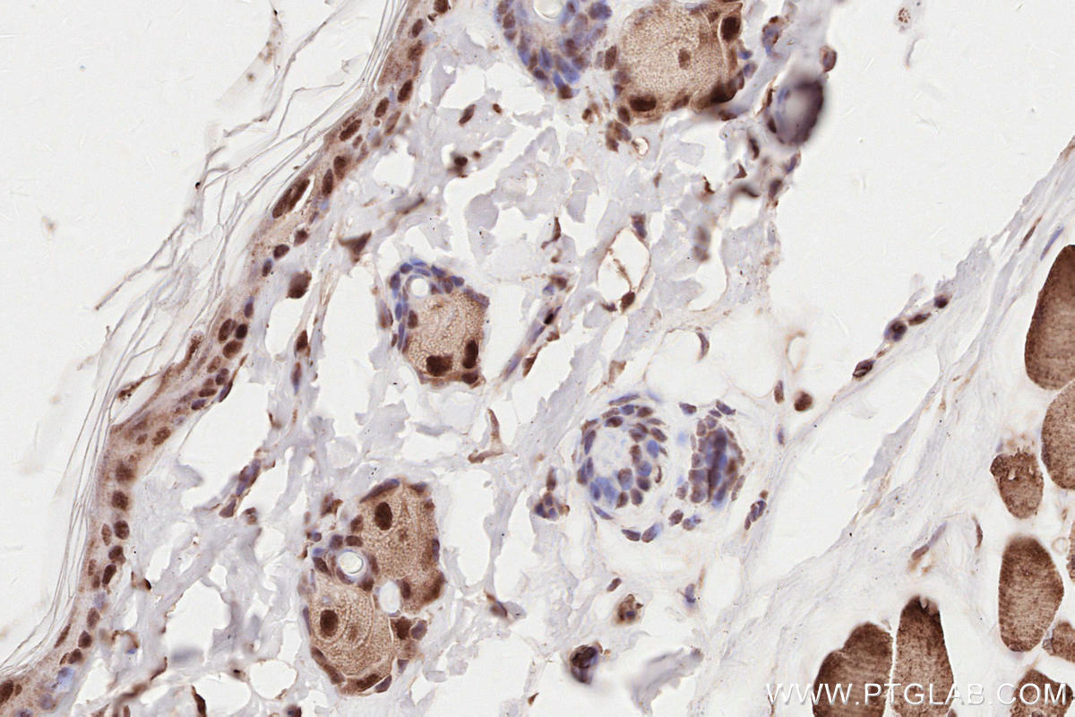 Immunohistochemistry (IHC) staining of rat skin tissue using HORMAD1 Polyclonal antibody (28719-1-AP)