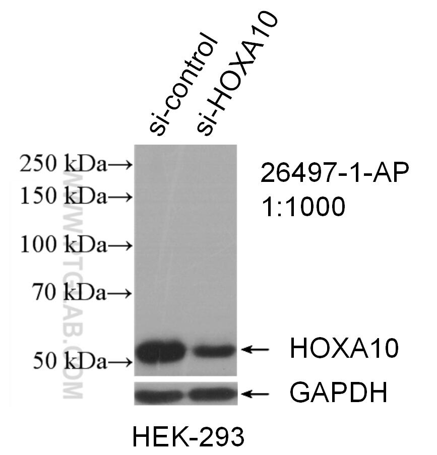 Western Blot (WB) analysis of HEK-293 cells using HOXA10 Polyclonal antibody (26497-1-AP)