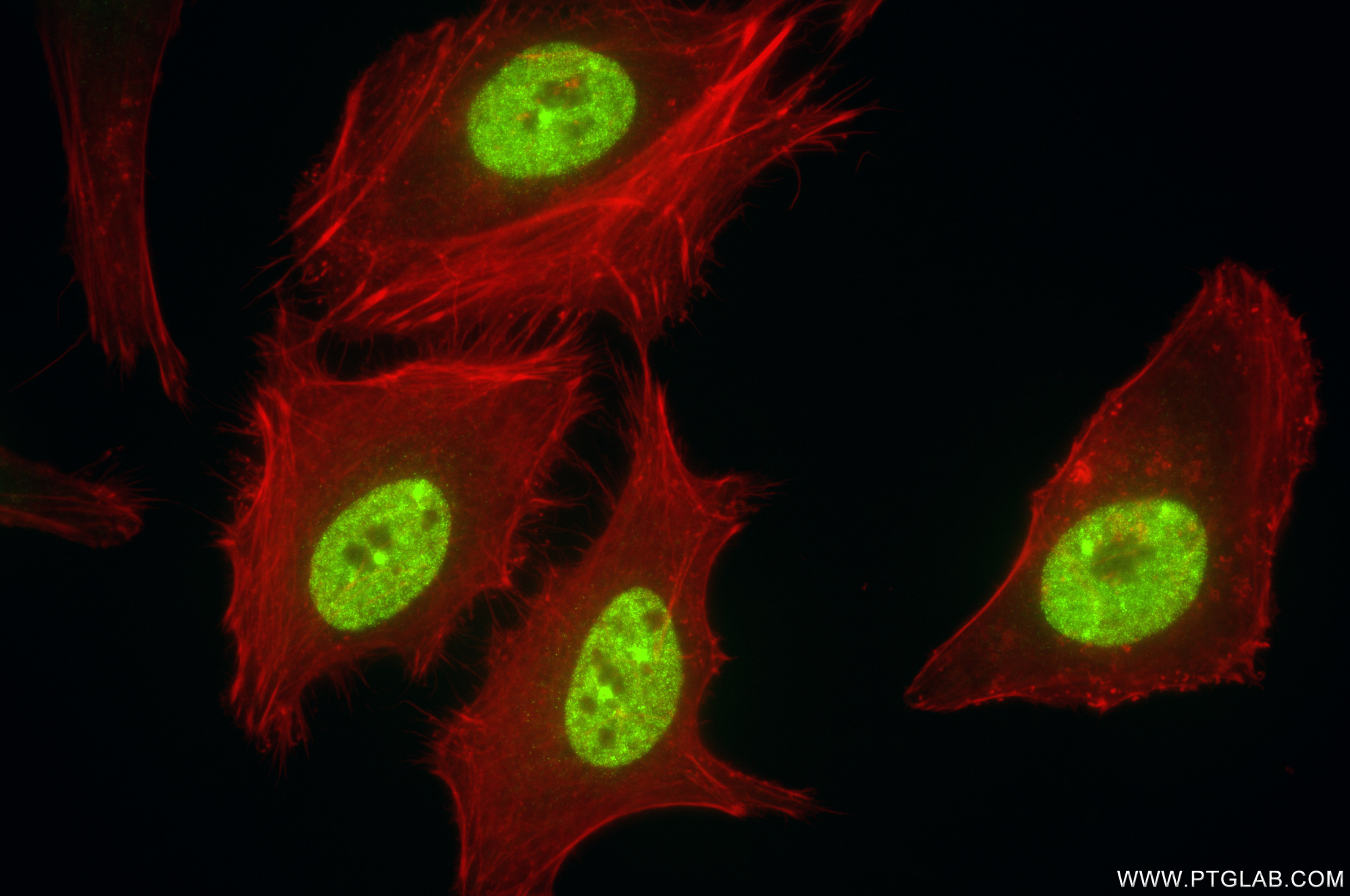 Immunofluorescence (IF) / fluorescent staining of HELA cells using HOXA10 Recombinant antibody (85951-2-RR)