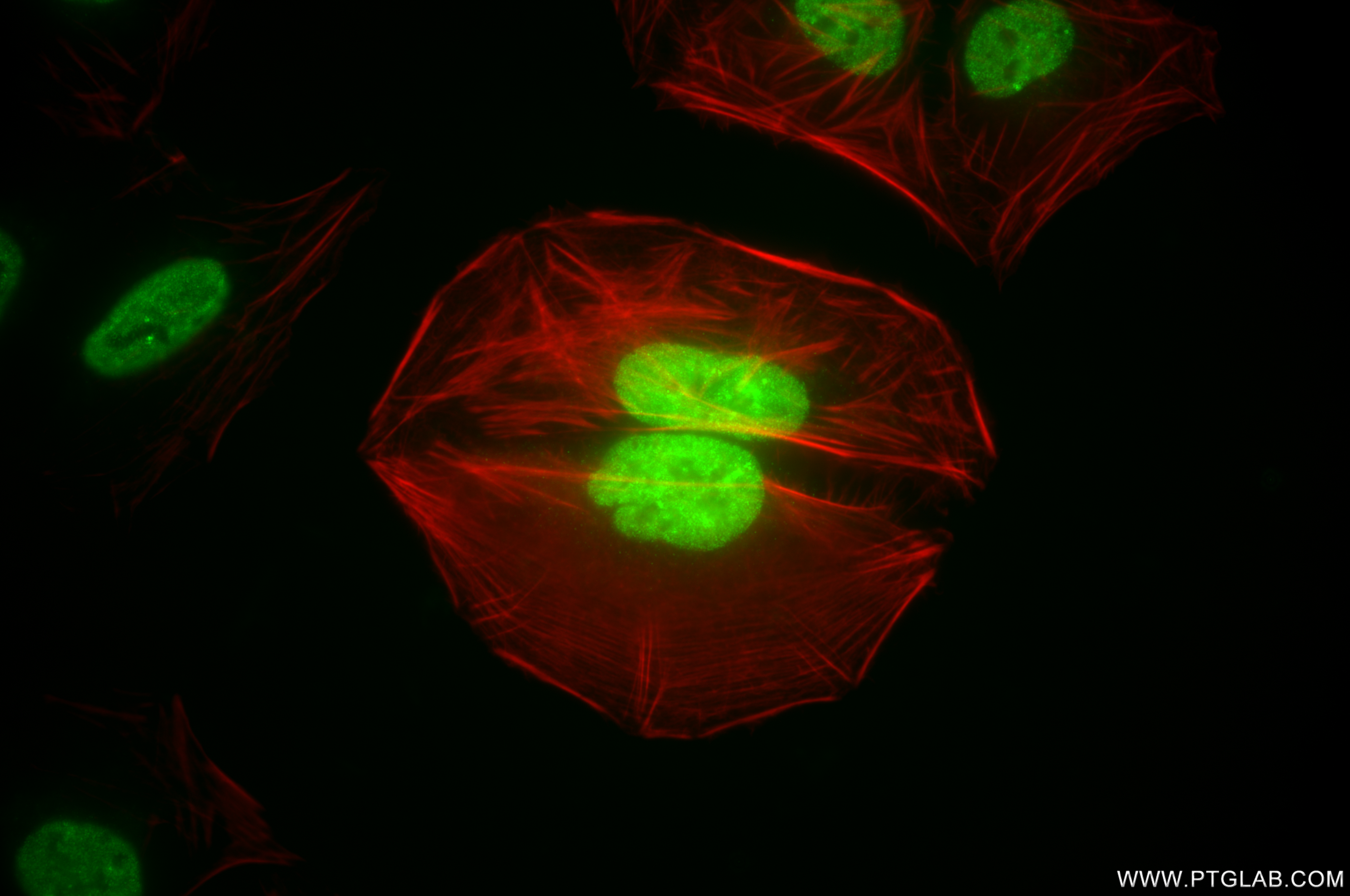 Immunofluorescence (IF) / fluorescent staining of U2OS cells using HOXA10 Recombinant antibody (85951-2-RR)