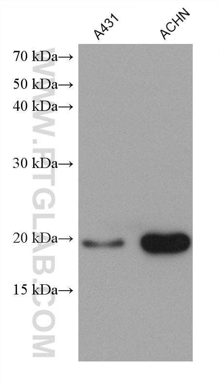 Western Blot (WB) analysis of various lysates using HOXA7 Monoclonal antibody (67112-1-Ig)