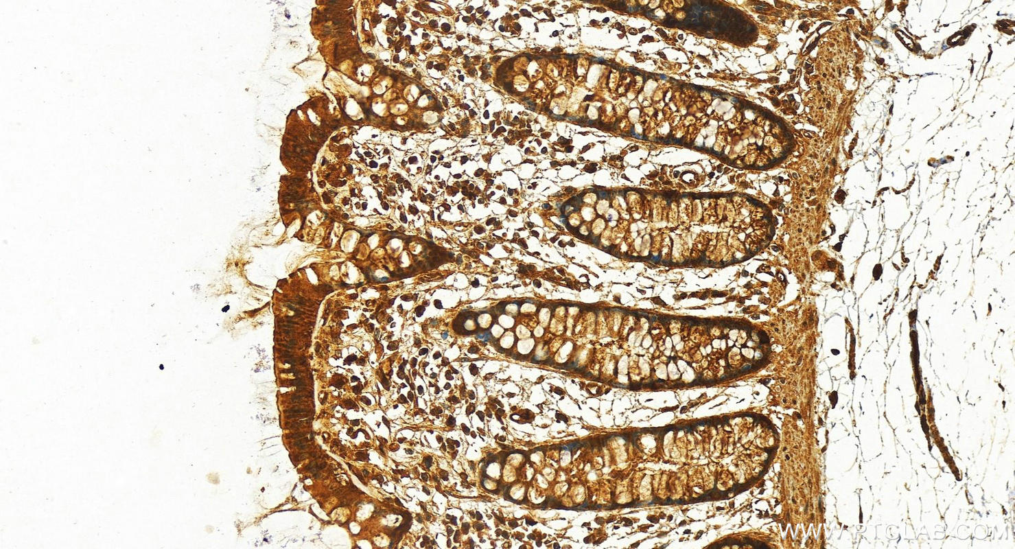 Immunohistochemistry (IHC) staining of human colon tissue using HOXA9 Polyclonal antibody (29978-1-AP)