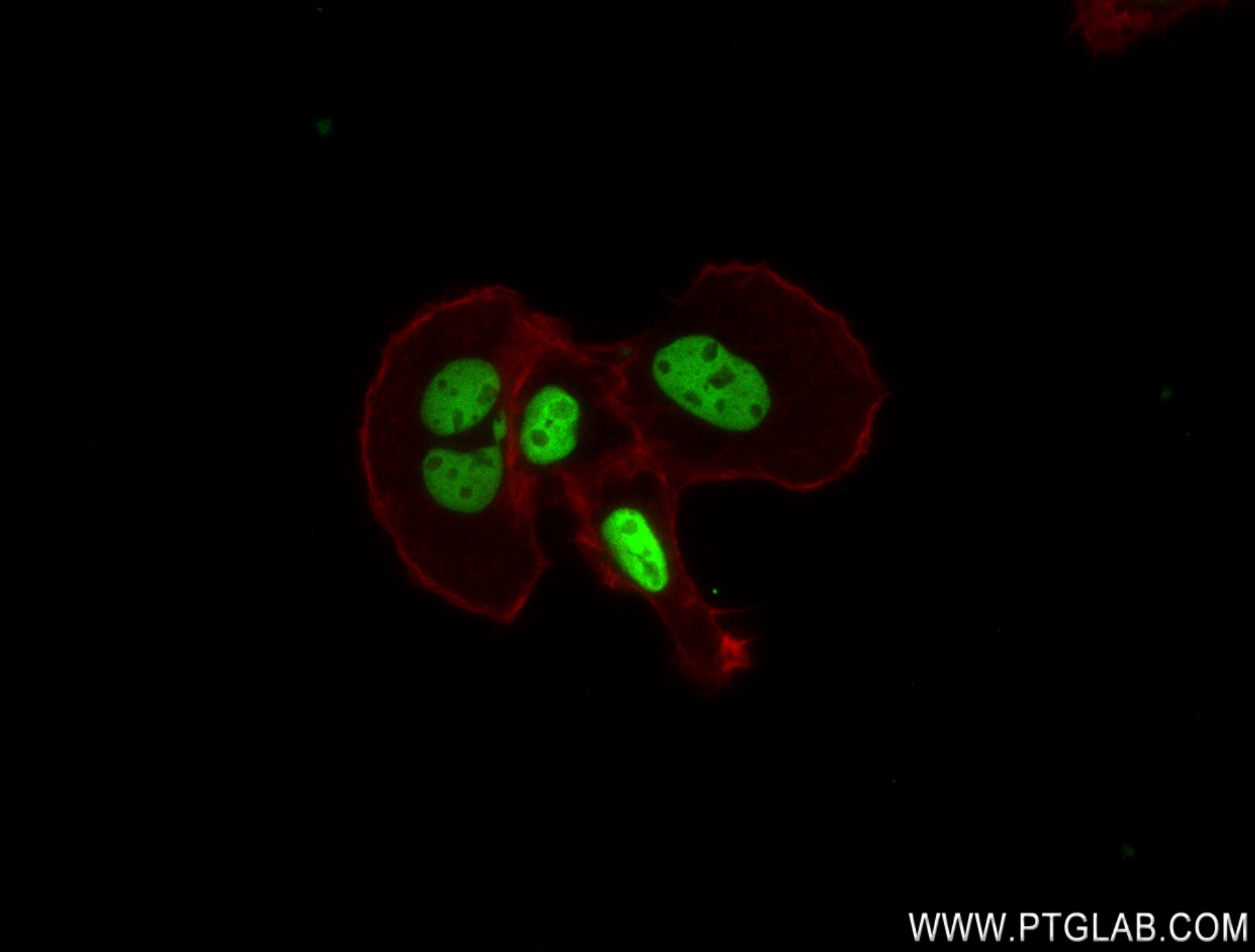 Immunofluorescence (IF) / fluorescent staining of A431 cells using HOXB6 Recombinant antibody (83155-4-RR)