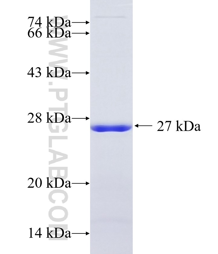 HOXB9 fusion protein Ag34837 SDS-PAGE