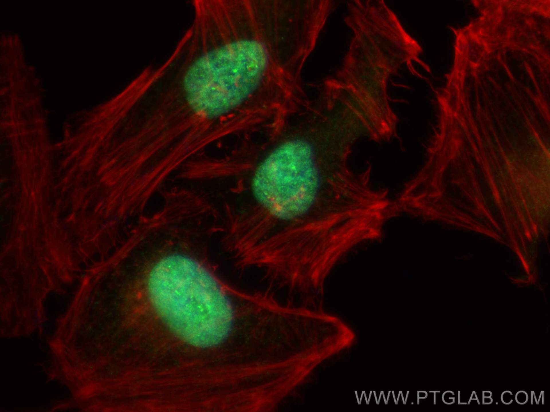 Immunofluorescence (IF) / fluorescent staining of HeLa cells using HOXC13 Polyclonal antibody (27002-1-AP)