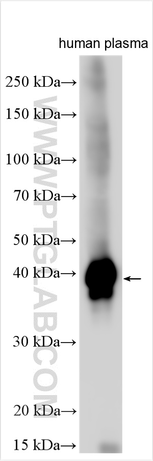 Western Blot (WB) analysis of various lysates using Haptoglobin Polyclonal antibody (16665-1-AP)