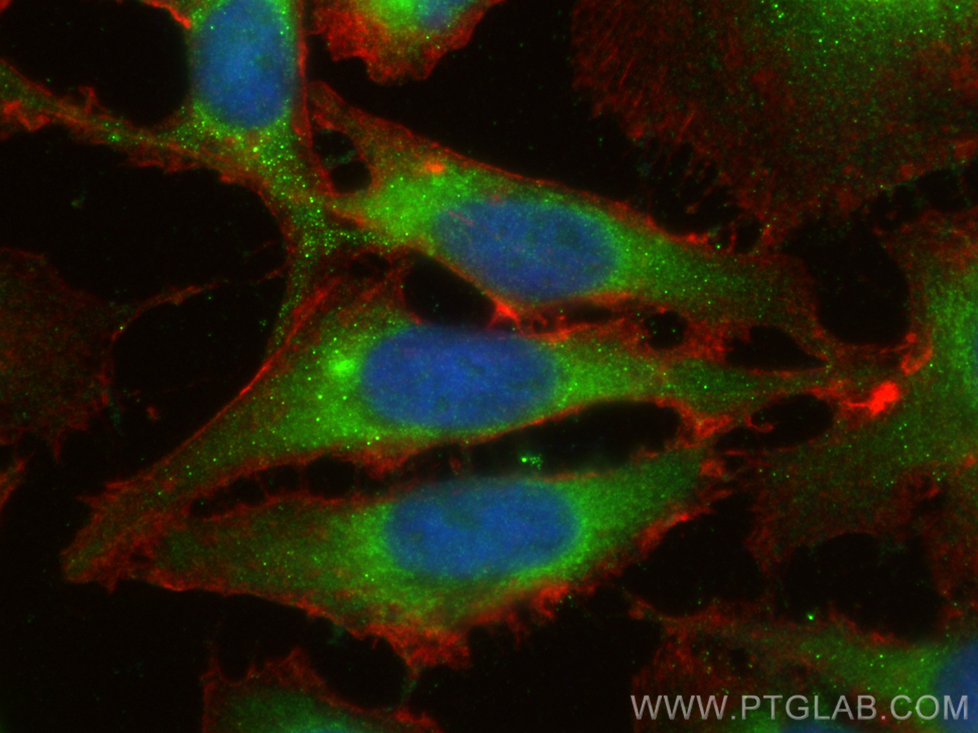 Immunofluorescence (IF) / fluorescent staining of HeLa cells using HPRT1 Polyclonal antibody (15059-1-AP)