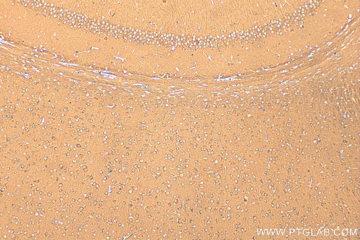 Immunohistochemistry (IHC) staining of mouse brain tissue using HPRT Polyclonal antibody (15059-1-AP)
