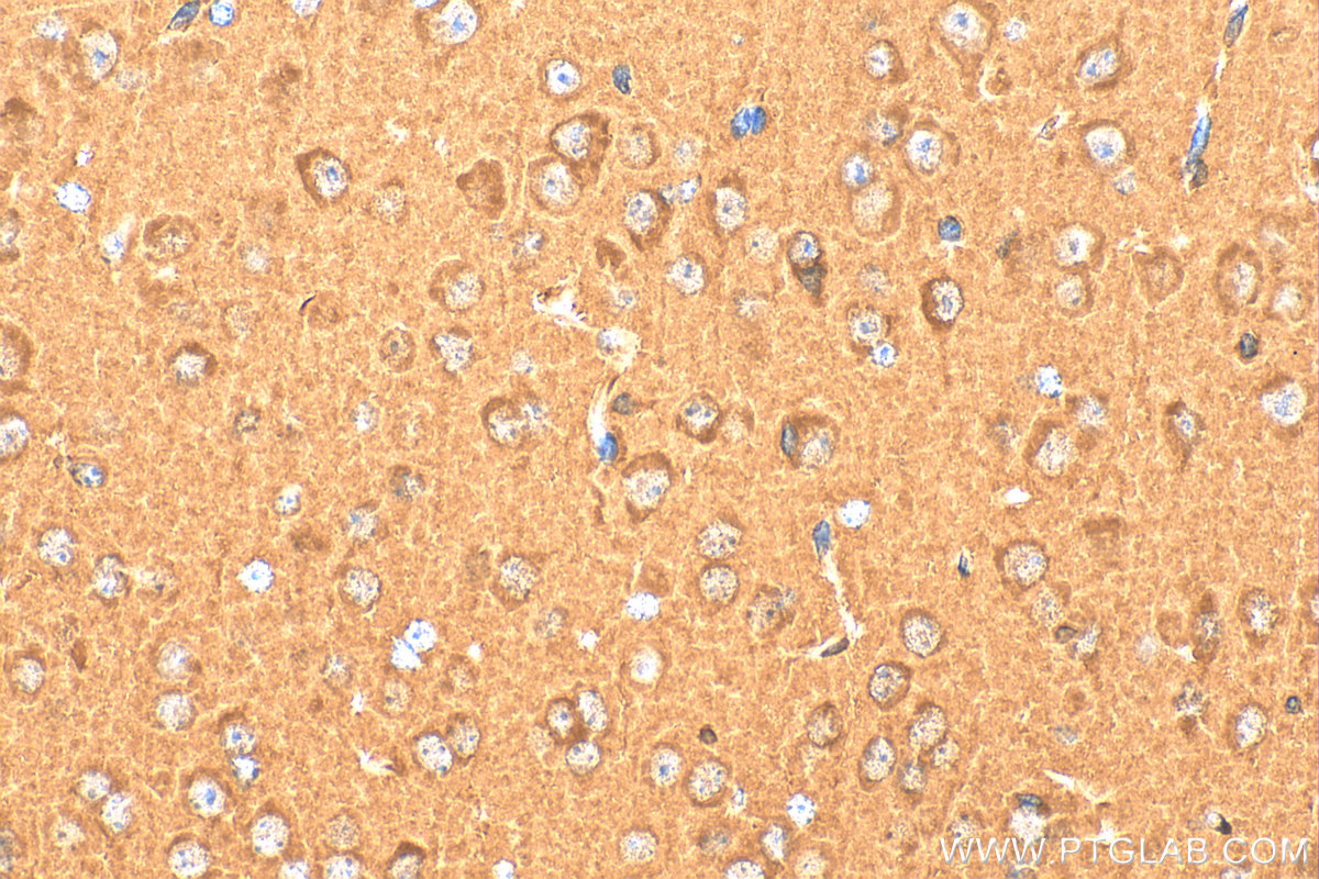Immunohistochemistry (IHC) staining of mouse brain tissue using HPRT Polyclonal antibody (15059-1-AP)