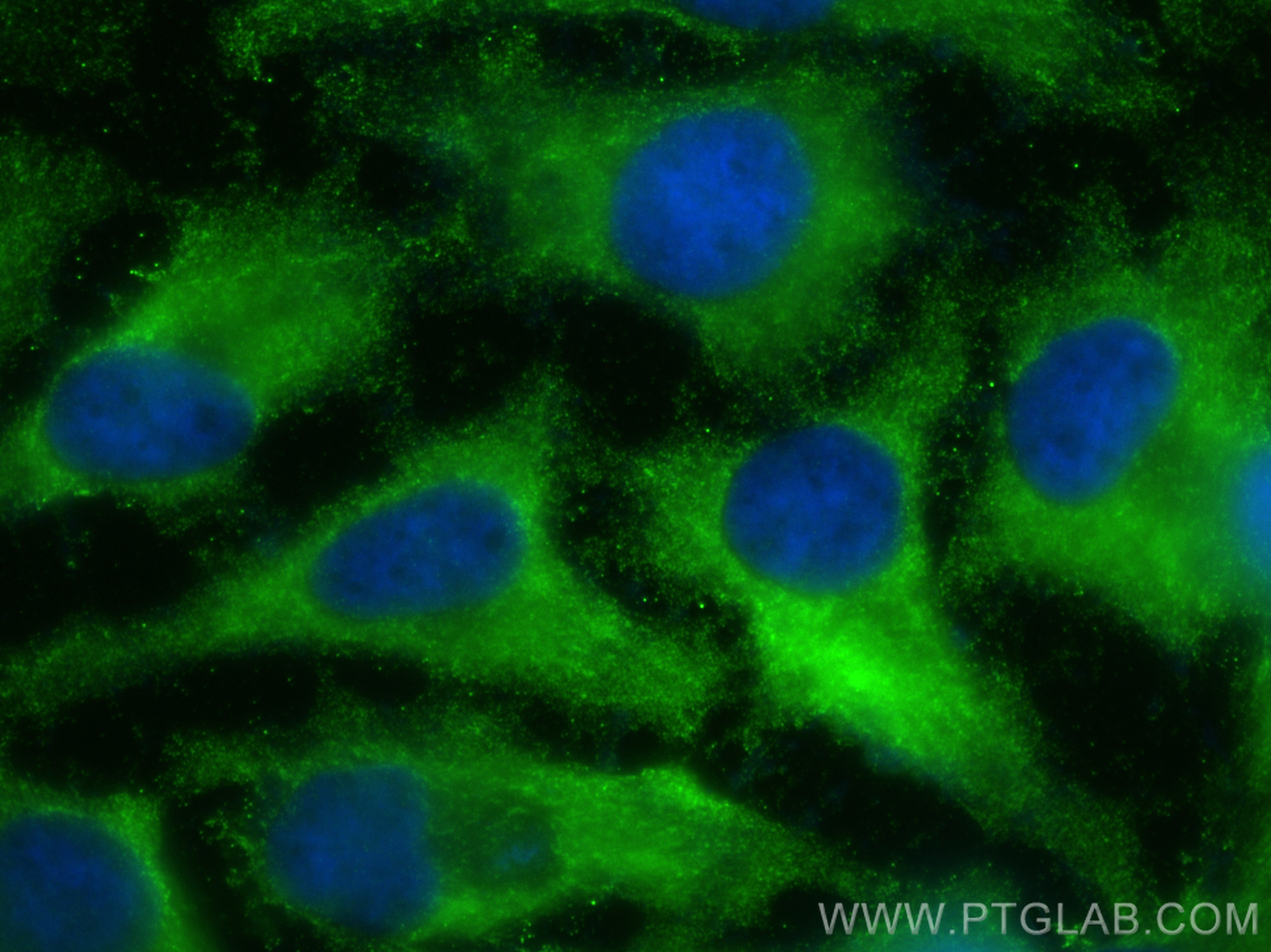 Immunofluorescence (IF) / fluorescent staining of HeLa cells using HPRT1 Monoclonal antibody (67518-1-Ig)