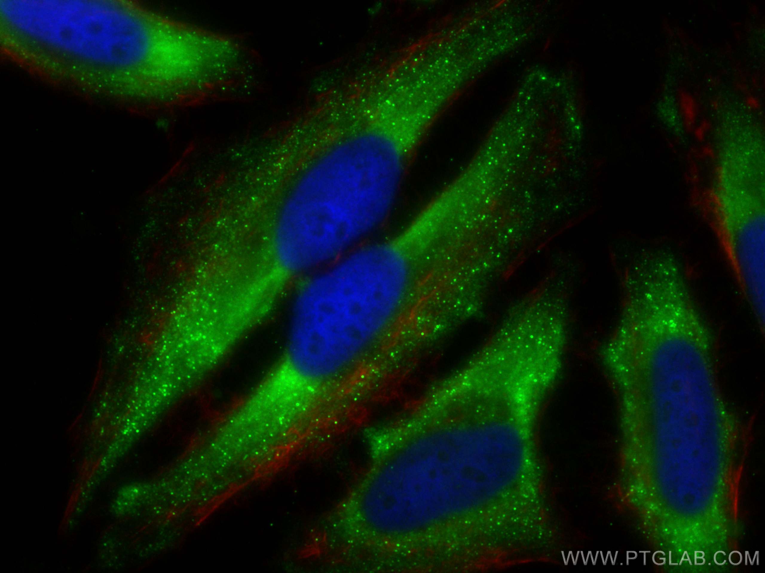 Immunofluorescence (IF) / fluorescent staining of HeLa cells using CoraLite® Plus 488-conjugated HPRT1 Polyclonal ant (CL488-15059)