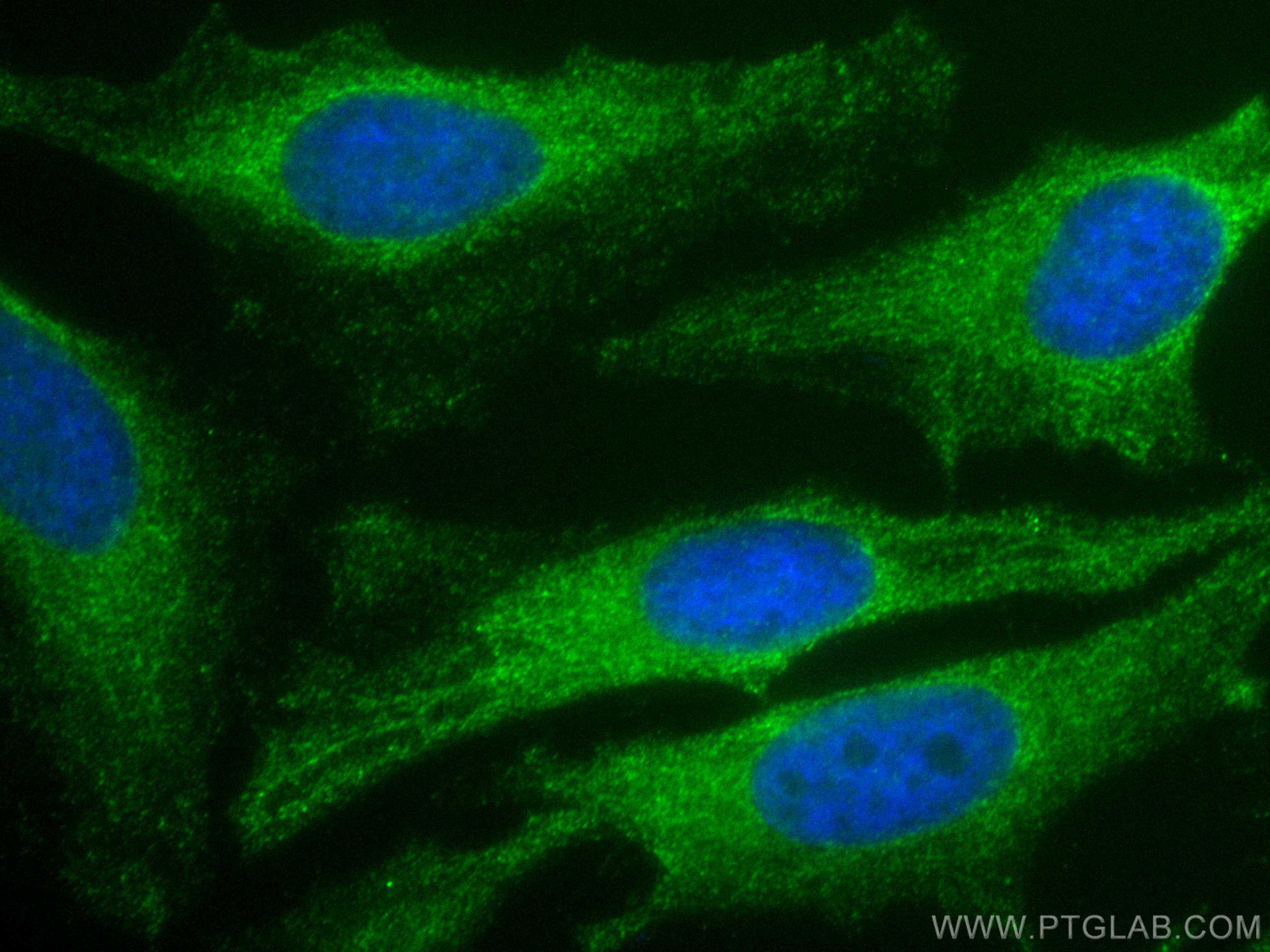 Immunofluorescence (IF) / fluorescent staining of HeLa cells using CoraLite® Plus 488-conjugated HPRT1 Monoclonal ant (CL488-67518)