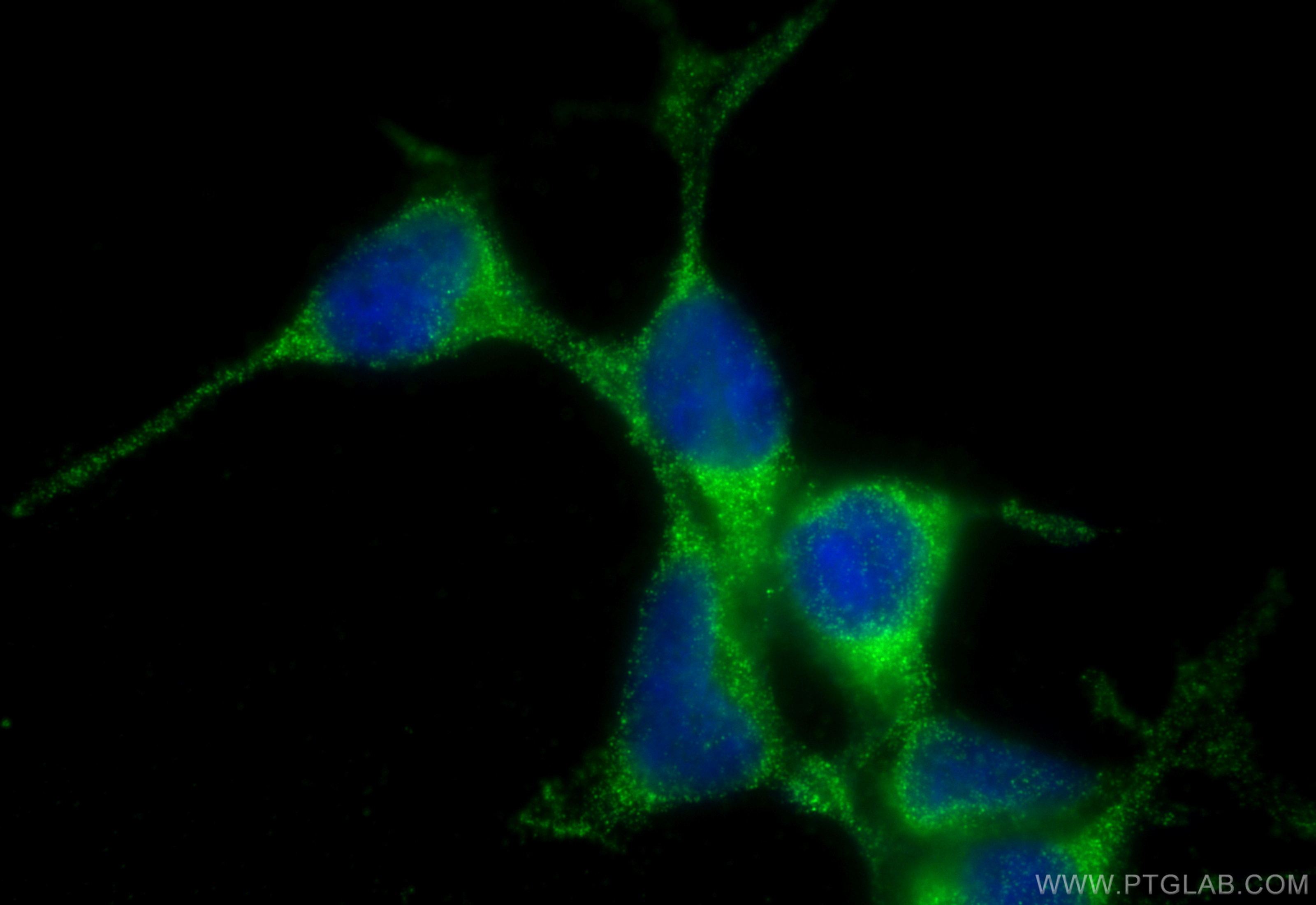 Immunofluorescence (IF) / fluorescent staining of HEK-293 cells using HPS1 Polyclonal antibody (15077-1-AP)