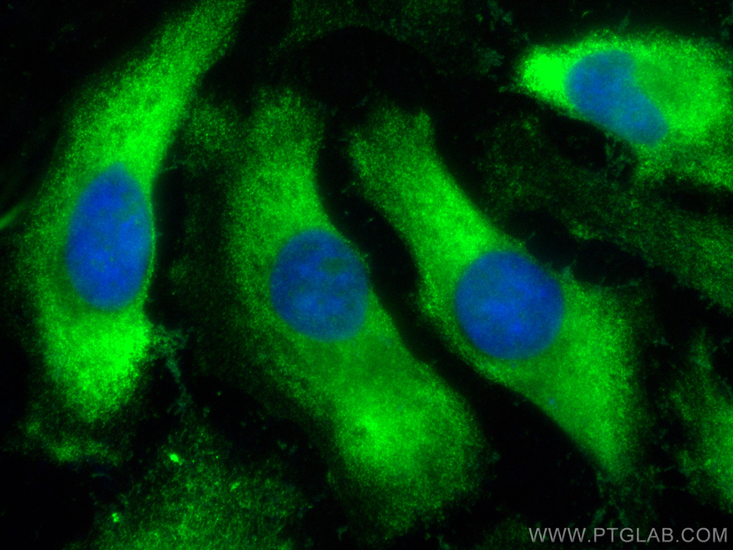 Immunofluorescence (IF) / fluorescent staining of HeLa cells using CoraLite® Plus 488-conjugated HPS3 Polyclonal anti (CL488-10768)