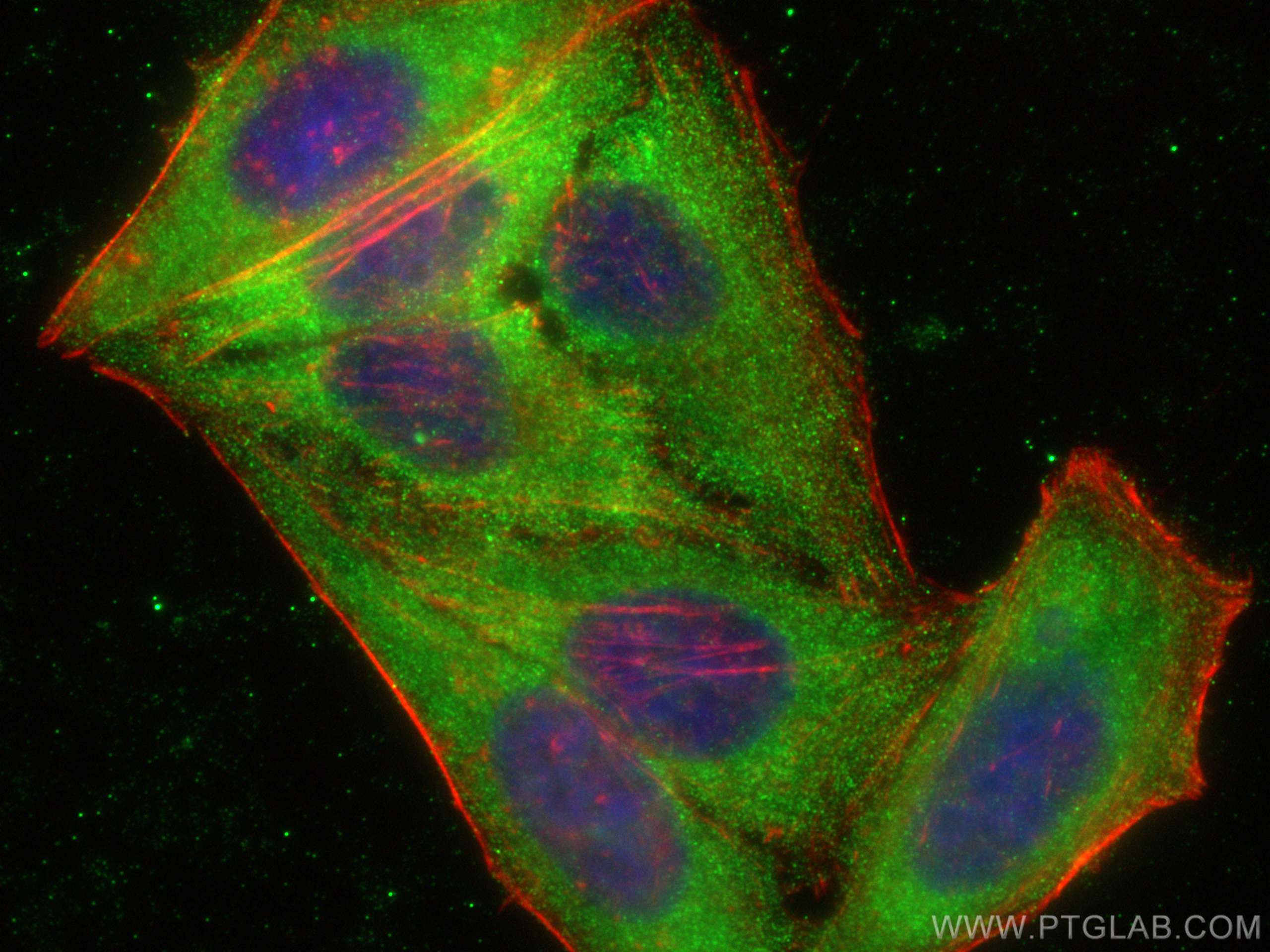 Immunofluorescence (IF) / fluorescent staining of HepG2 cells using HPS4 Polyclonal antibody (14627-1-AP)
