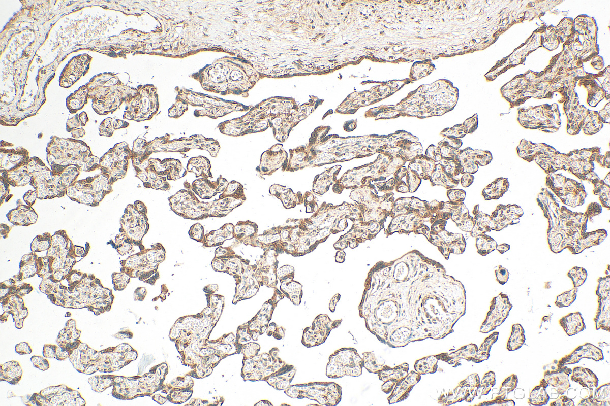 Immunohistochemistry (IHC) staining of human placenta tissue using HPSE Polyclonal antibody (24529-1-AP)