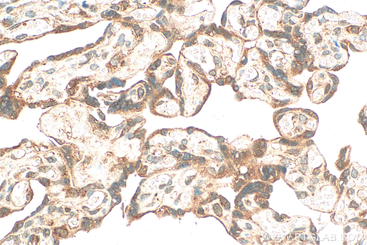 Immunohistochemistry (IHC) staining of human placenta tissue using HPSE Polyclonal antibody (24529-1-AP)