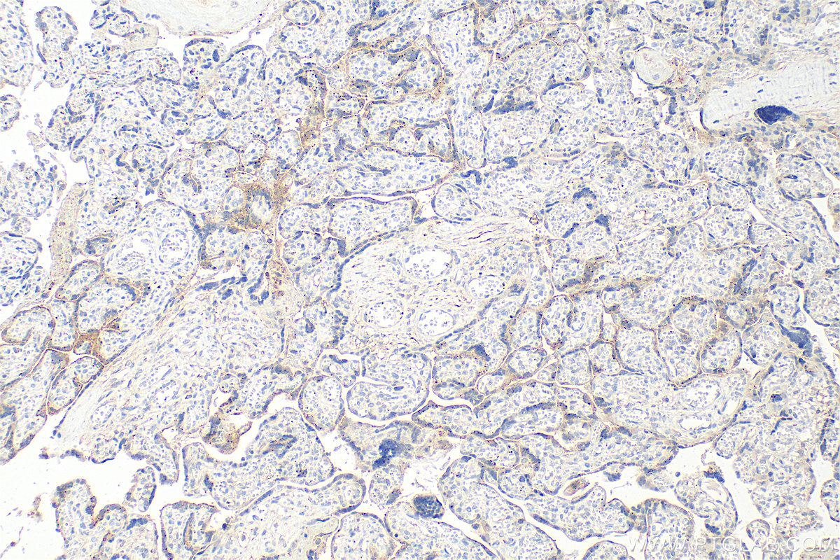 Immunohistochemistry (IHC) staining of human placenta tissue using HPSE Recombinant antibody (84562-1-RR)