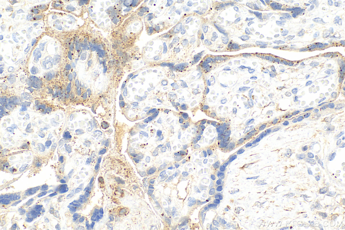 Immunohistochemistry (IHC) staining of human placenta tissue using HPSE Recombinant antibody (84562-1-RR)