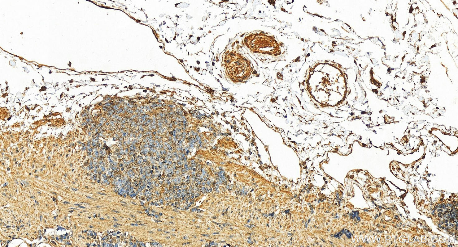 Immunohistochemistry (IHC) staining of human stomach tissue using HRAS Polyclonal antibody (15531-1-AP)