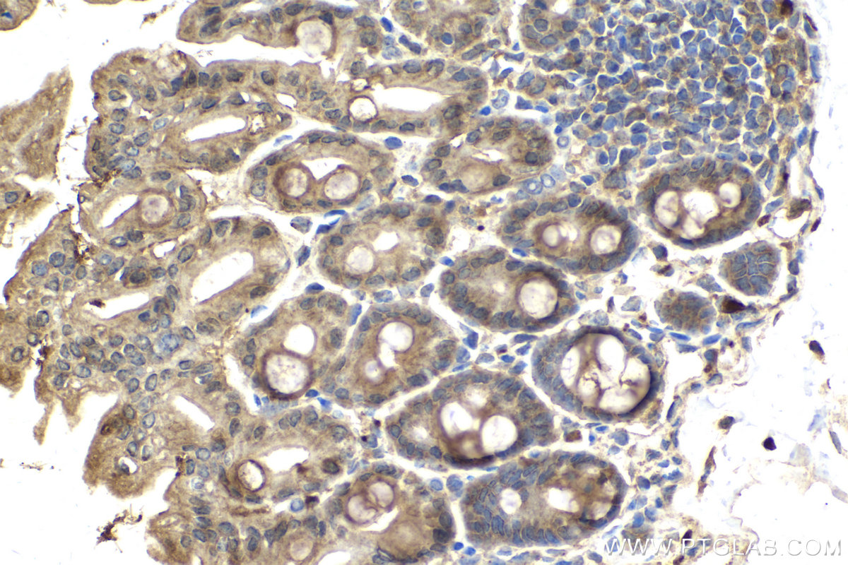 Immunohistochemistry (IHC) staining of mouse intestine using HRAS Polyclonal antibody (15531-1-AP)