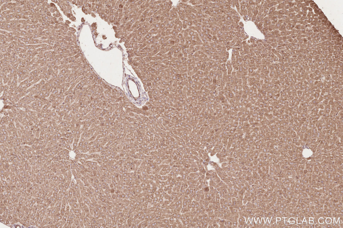 Immunohistochemistry (IHC) staining of mouse liver tissue using HRD1/SYVN1 Monoclonal antibody (67488-1-Ig)