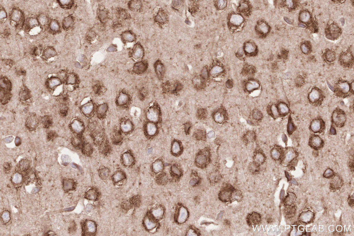 Immunohistochemistry (IHC) staining of mouse brain tissue using HRD1/SYVN1 Monoclonal antibody (67488-1-Ig)