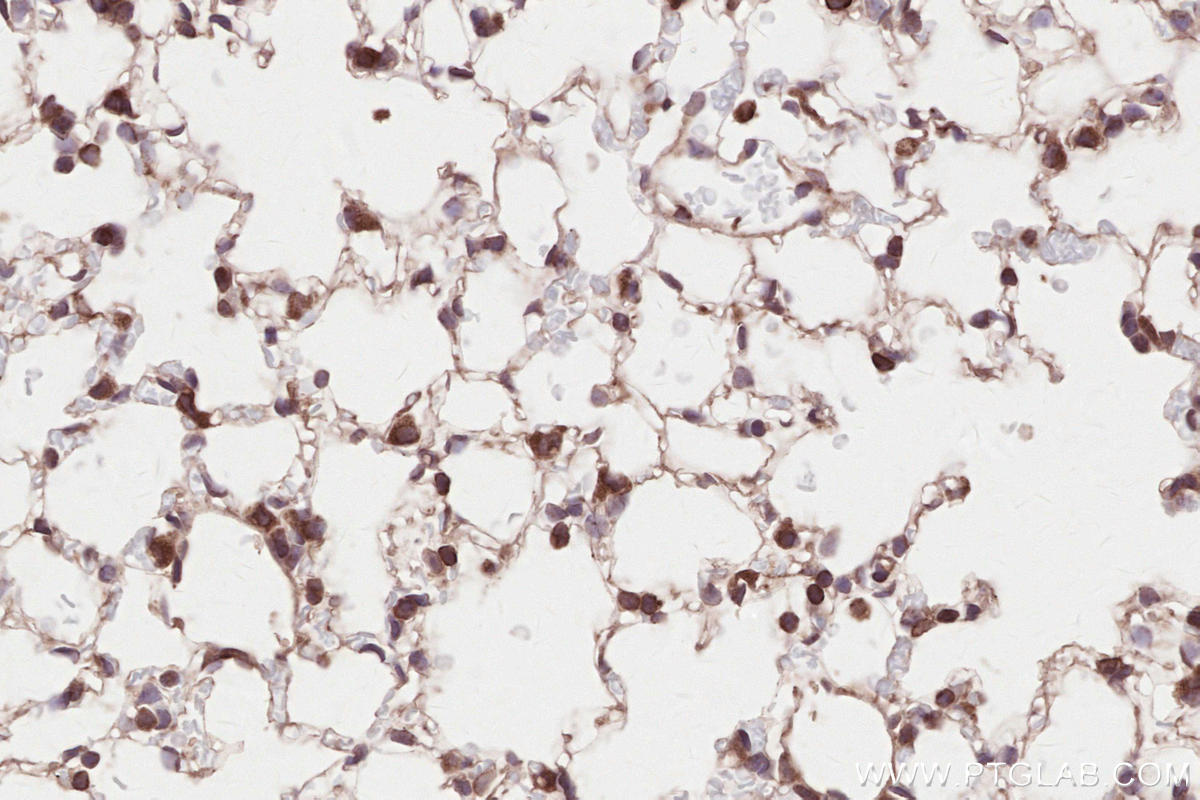 Immunohistochemistry (IHC) staining of mouse lung tissue using HRD1/SYVN1 Monoclonal antibody (67488-1-Ig)