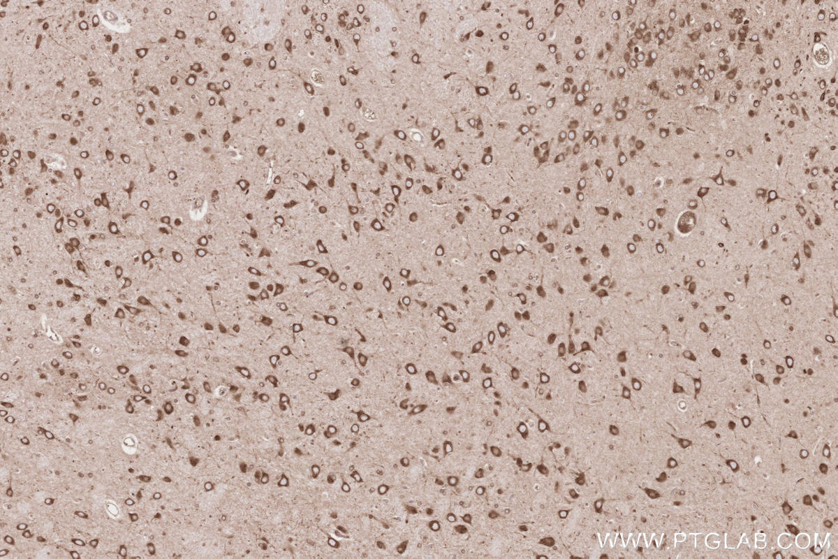 Immunohistochemistry (IHC) staining of rat brain tissue using HRD1/SYVN1 Monoclonal antibody (67488-1-Ig)