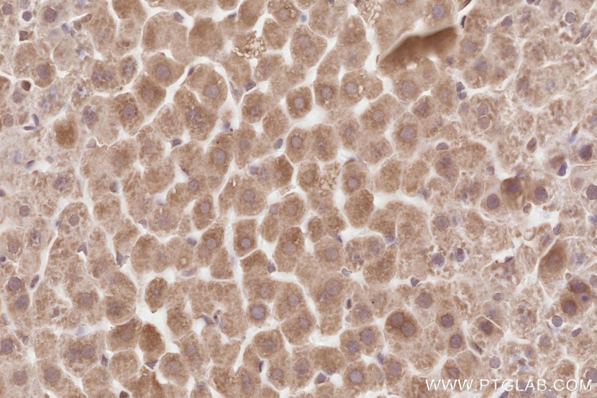 Immunohistochemistry (IHC) staining of rat liver tissue using HRD1/SYVN1 Monoclonal antibody (67488-1-Ig)