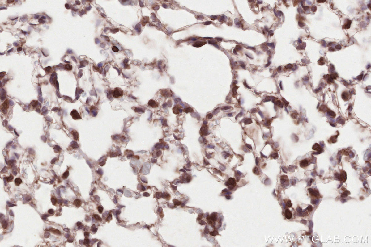 Immunohistochemistry (IHC) staining of rat lung tissue using HRD1/SYVN1 Monoclonal antibody (67488-1-Ig)
