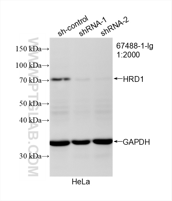 Western Blot (WB) analysis of HeLa cells using HRD1/SYVN1 Monoclonal antibody (67488-1-Ig)