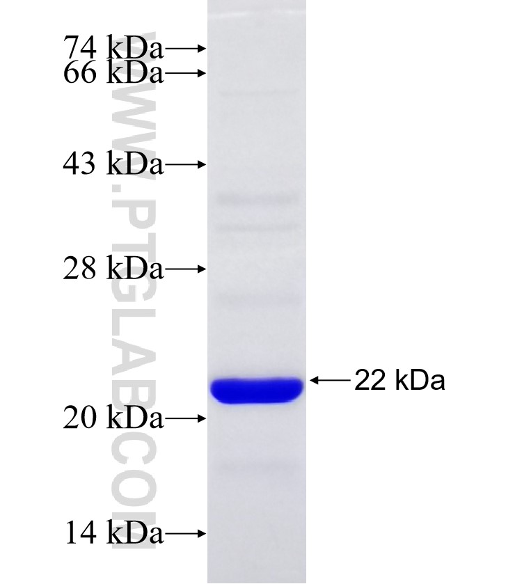 HSD11B2 fusion protein Ag30579 SDS-PAGE