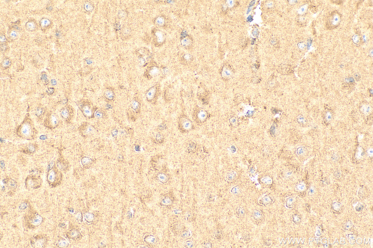 Immunohistochemistry (IHC) staining of mouse brain tissue using ERAB Polyclonal antibody (10648-1-AP)