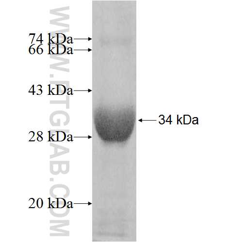 HSD17B14 fusion protein Ag8246 SDS-PAGE