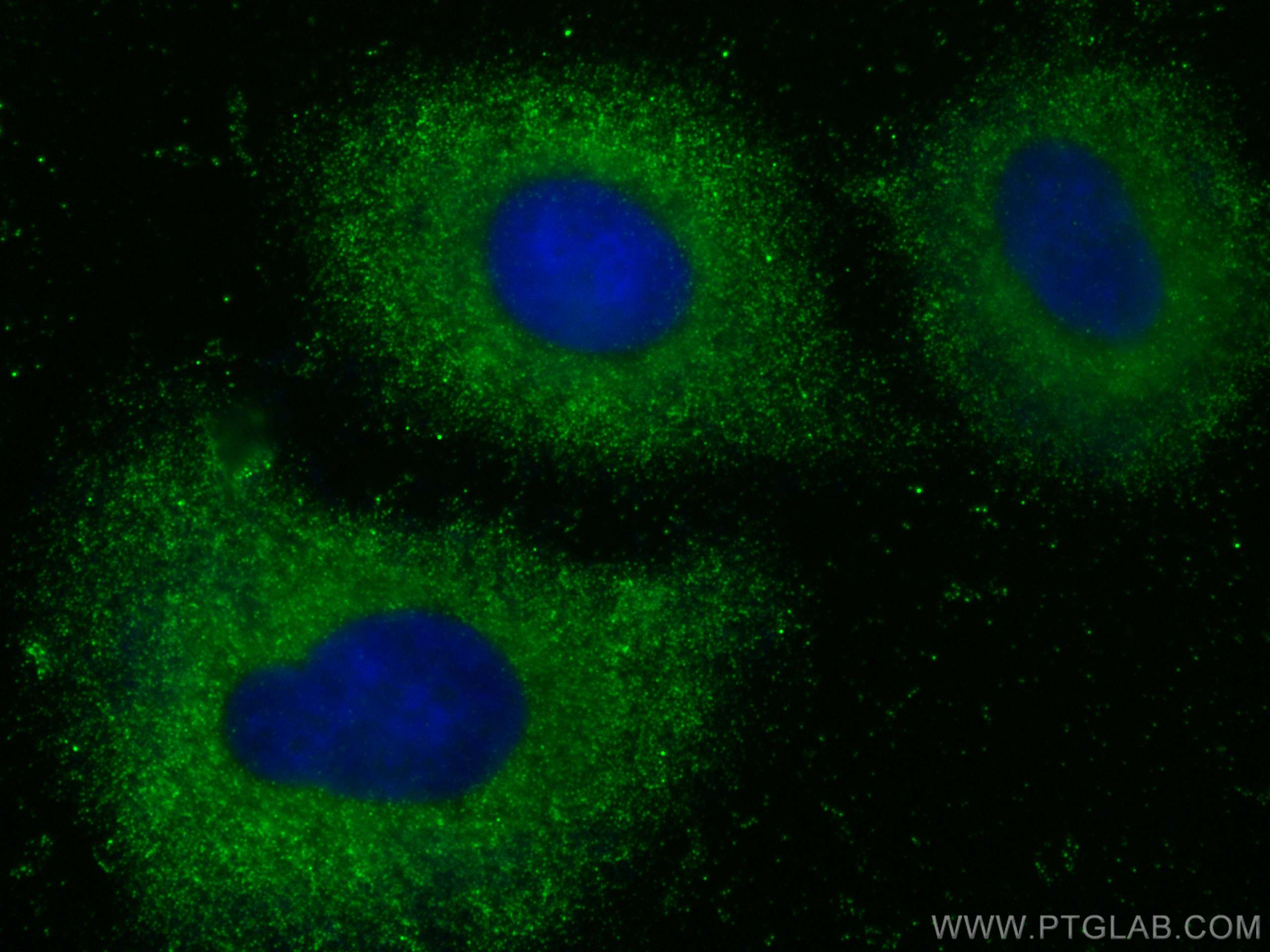 Immunofluorescence (IF) / fluorescent staining of A549 cells using HSD3B2 Monoclonal antibody (67572-1-Ig)