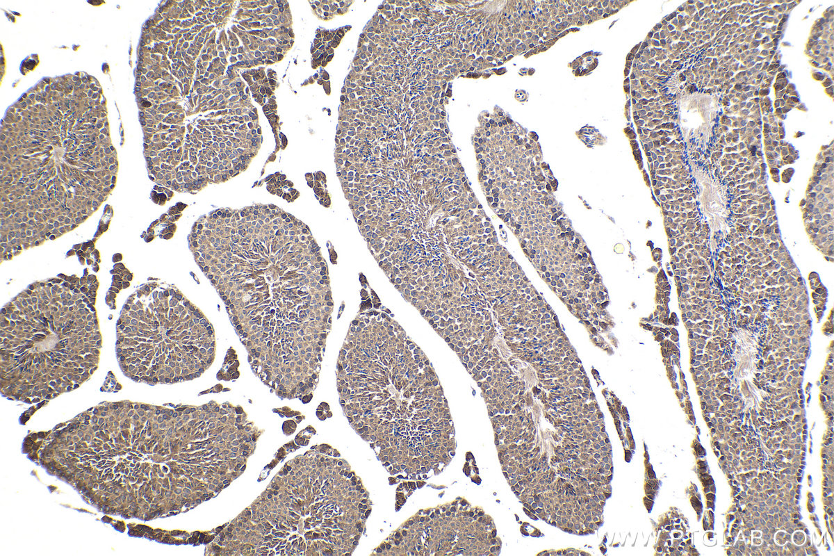 Immunohistochemistry (IHC) staining of mouse testis tissue using HSF2 Polyclonal antibody (10706-1-AP)