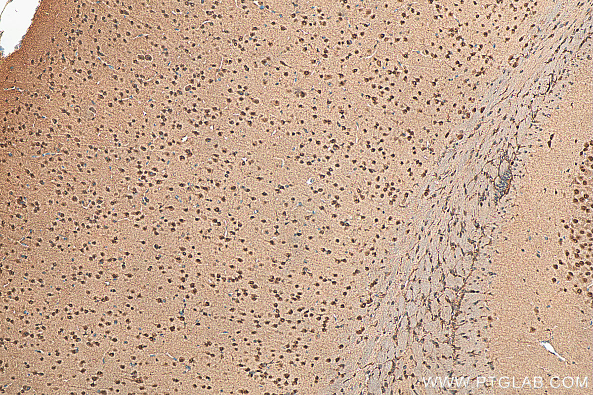 Immunohistochemistry (IHC) staining of mouse brain tissue using HSF4 Polyclonal antibody (22883-1-AP)