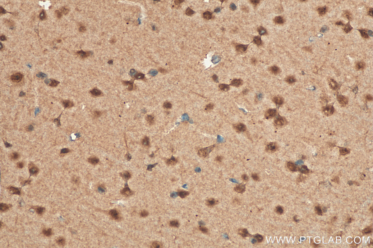 Immunohistochemistry (IHC) staining of mouse brain tissue using HSF4 Polyclonal antibody (22883-1-AP)