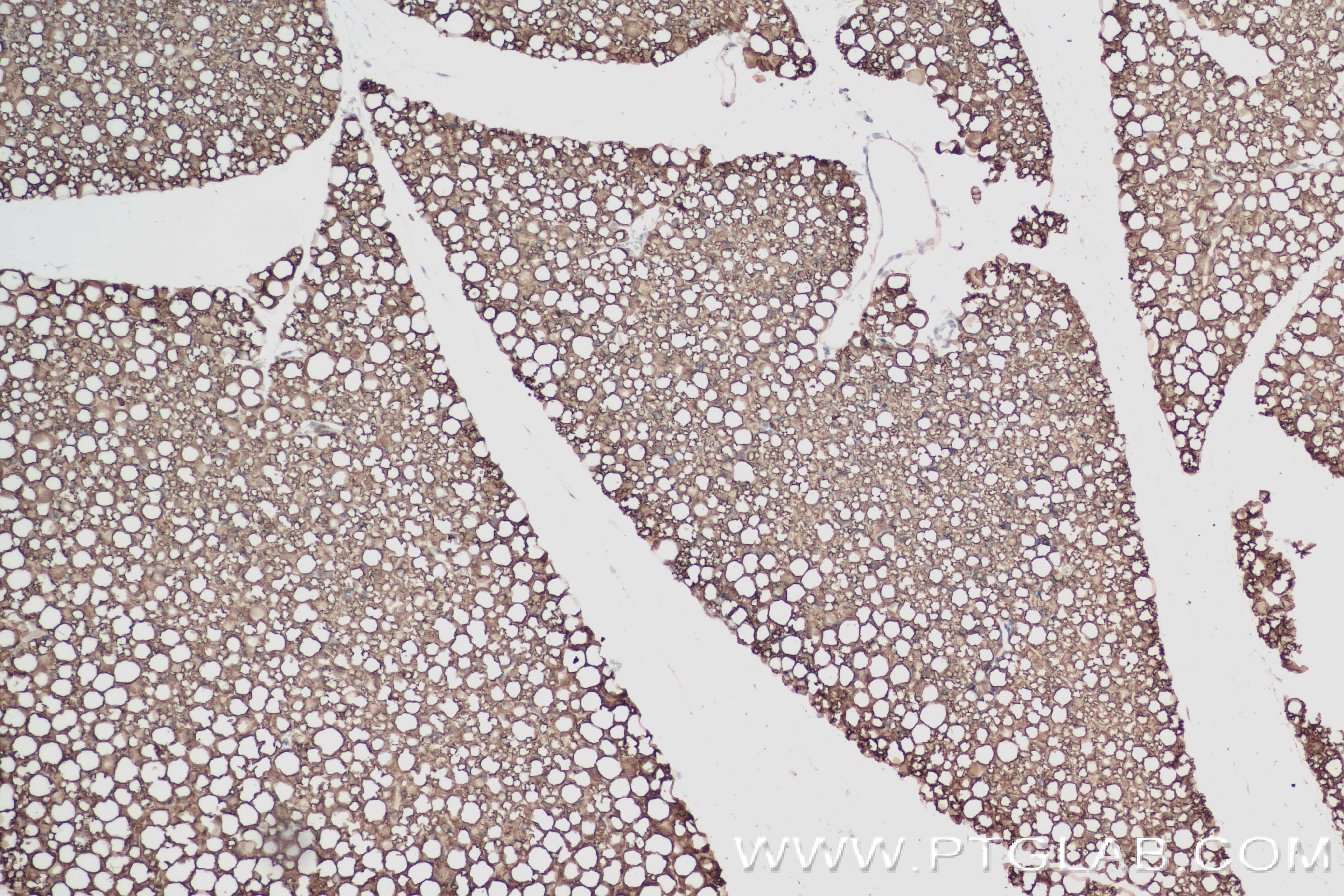 Immunohistochemistry (IHC) staining of mouse brown adipose tissue using HSL Recombinant antibody (84540-1-RR)