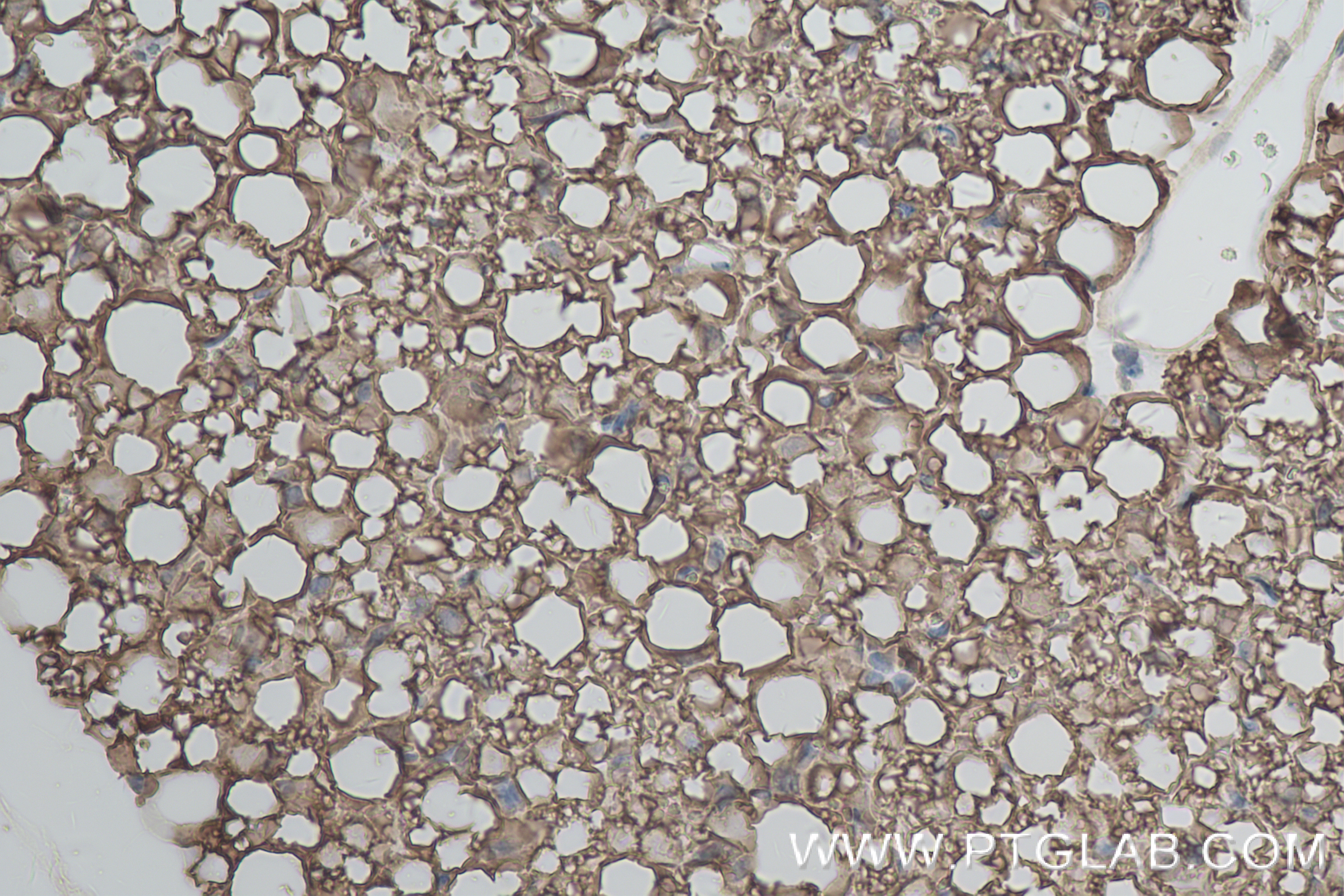 Immunohistochemistry (IHC) staining of mouse brown adipose tissue using HSL Recombinant antibody (84540-1-RR)