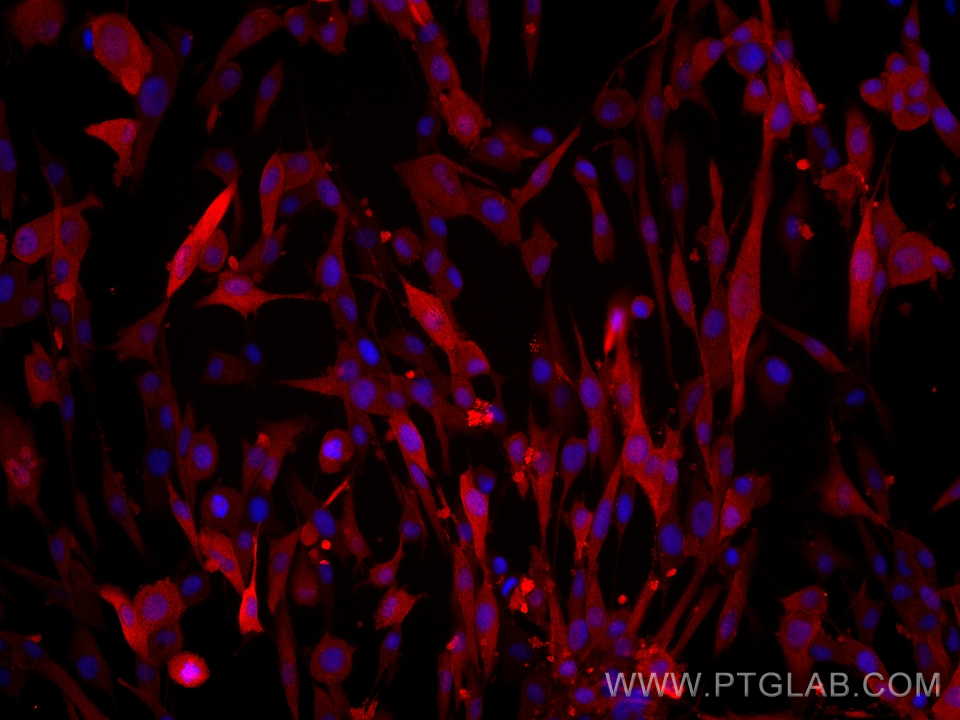 Immunofluorescence (IF) / fluorescent staining of U-118 MG cells using HSP20 Monoclonal antibody (67327-1-Ig)