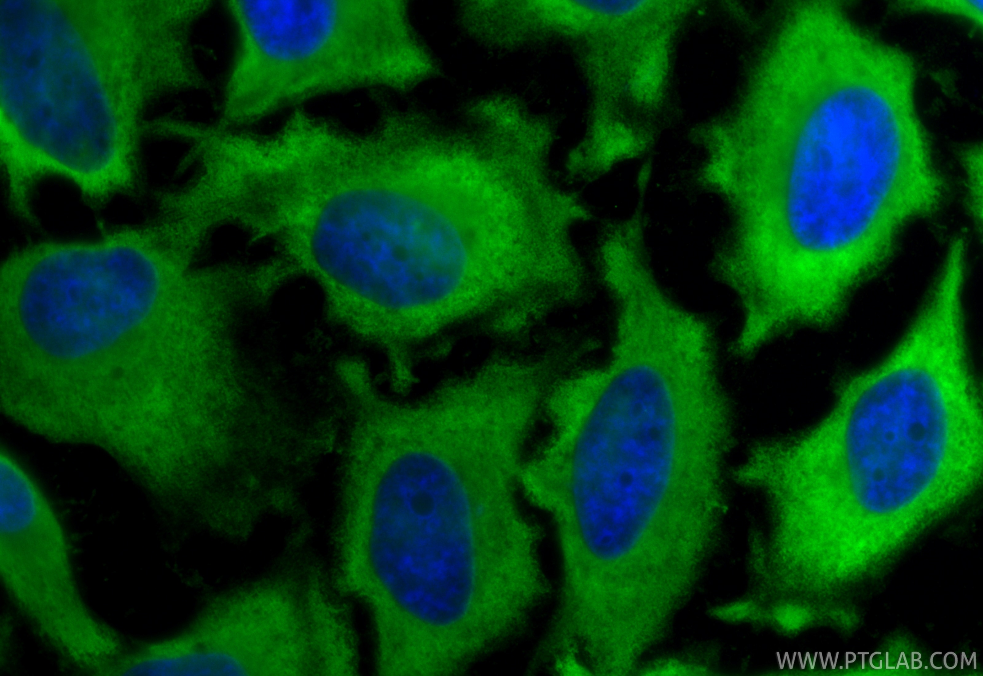 Immunofluorescence (IF) / fluorescent staining of HeLa cells using HSPA1B Polyclonal antibody (25405-1-AP)