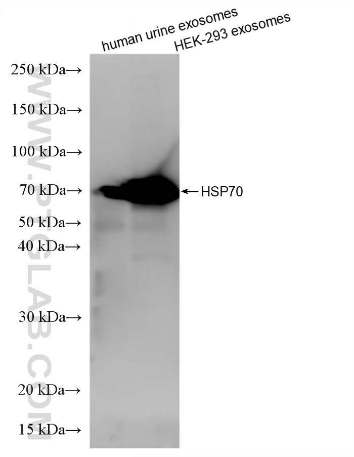 Western Blot (WB) analysis of various lysates using HSP70 Recombinant monoclonal antibody (80735-1-RR)